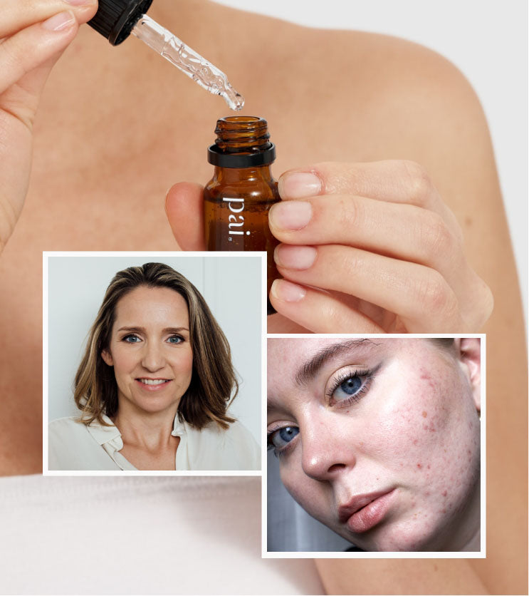 Shop With Sarah: Salicylic Acid Booster Launch